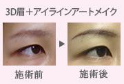 �N���j�b�N�摜