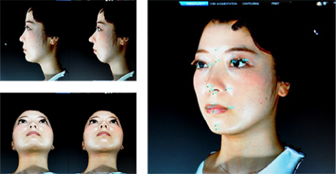 nose image left